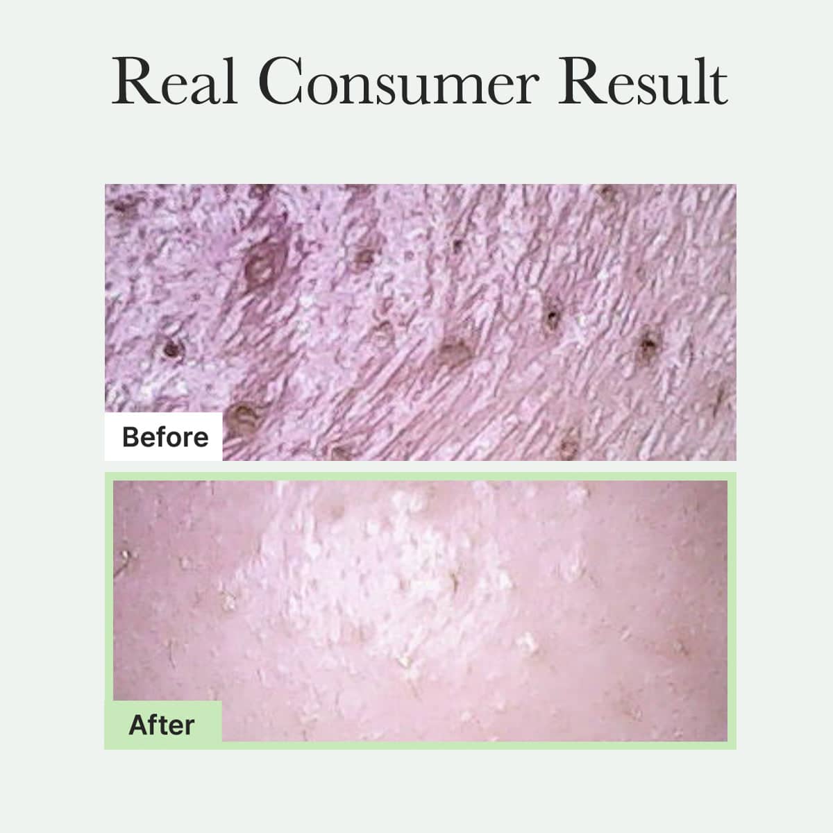 private label rice cake facial cleanser